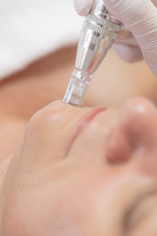 Kosmetisches Microneedling