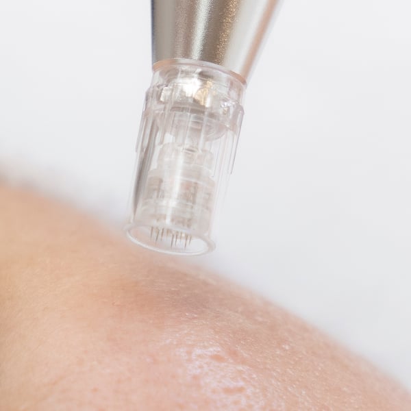 Micro-Needling